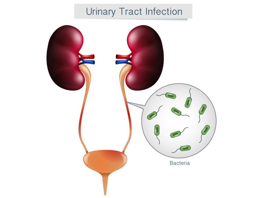 uti